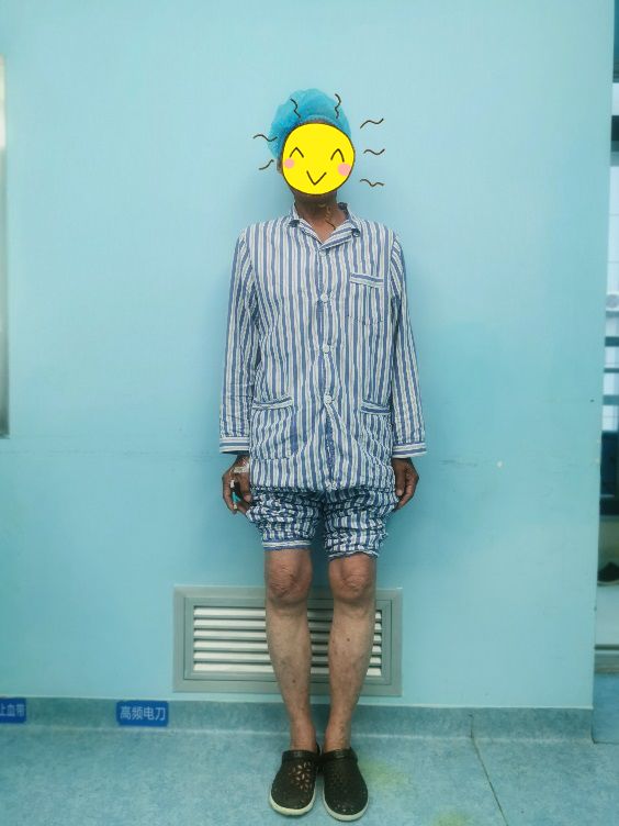 乔治近期训练受伤已接受左膝关节镜手术的简单介绍